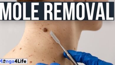 Safe and Effective Mole Removal Solutions in Sydney